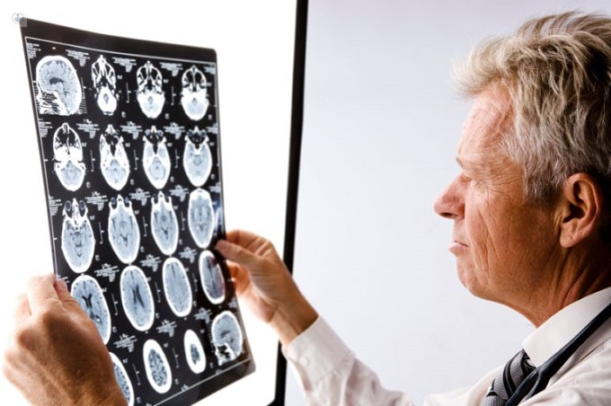 Neurólogo viendo el cerebro